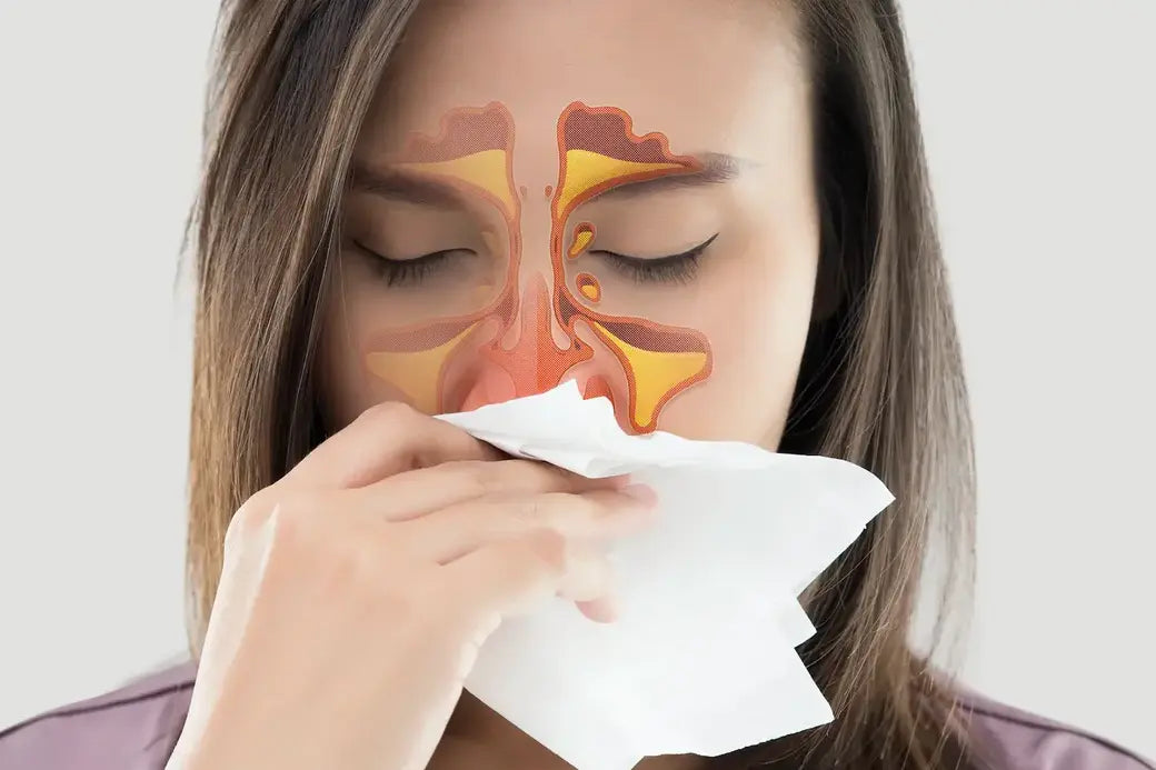 upala-sinusa-lijecenje-simptomi-iskustvaa