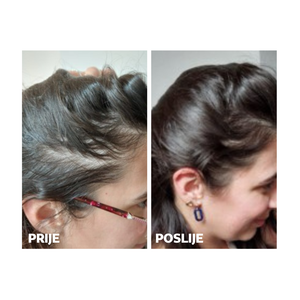 Yasenka Skinage HAIR STRONG 60 kapsula