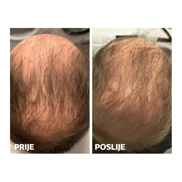 Yasenka Skinage HAIR STRONG MEN 60 kapsula