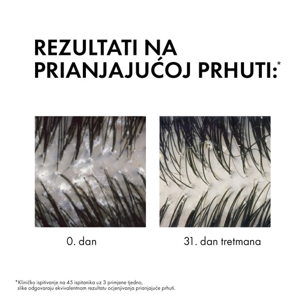 Vichy Dercos Šampon protiv prhuti za suhu kosu 200 ml