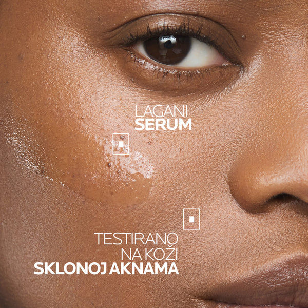 La Roche-Posay Effaclar Ultra koncentrirani serum 30 ml