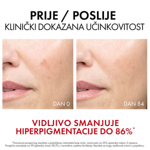 Vichy Liftactiv B3 Dark spots serum 30 ml