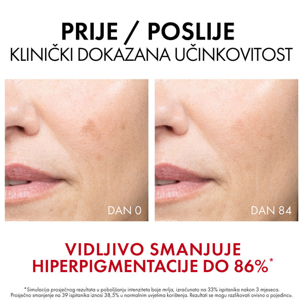 Vichy Liftactiv B3 Dark spots serum 30 ml
