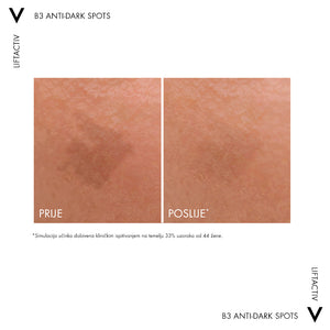 Vichy Liftactiv B3 Dark spots serum 30 ml