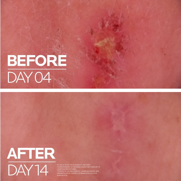 La Roche-Posay CICAPLAST Baume B5+ Ultra-obnavljajući smirujući balzam za iritacije i osjećaj vrućine na koži 40 ml