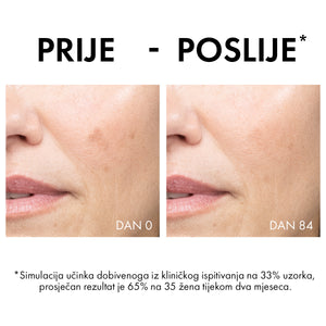Vichy Liftactiv Pigment Specialist B3 krema protiv hiperpigmentacijskih mrlja SPF50 50 ml