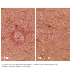 La Roche-Posay Effaclar Duo+M 40 ml
