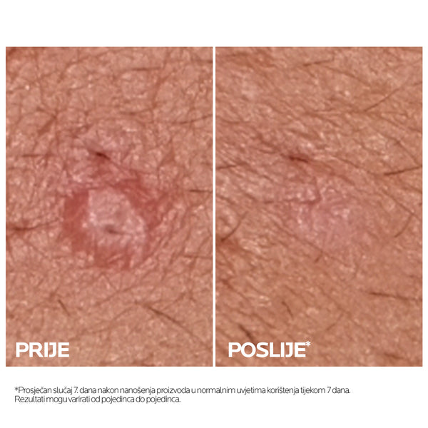 La Roche-Posay Effaclar Duo+M 40 ml
