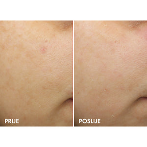 VICHY LIFTACTIV B3 ANTI-DARK SPOTS Noćna krema protiv hiperpigmentacijskih mrlja sa čistim retinolom 50 ml