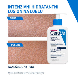 CeraVe Intenzivni Hidratantni losion za normalnu do suhu kožu 473 ml