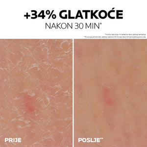 La Roche-Posay LIPIKAR gel s 30% ureje za ciljanu primjenu na suha i gruba područja kože, 50 ml