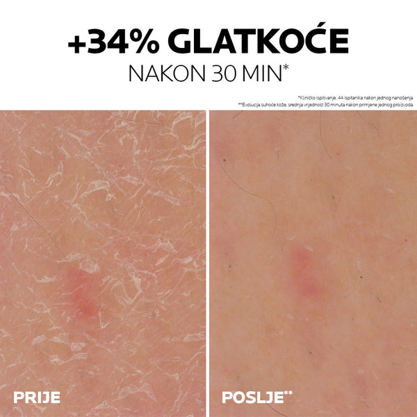 La Roche-Posay LIPIKAR gel s 30% ureje za ciljanu primjenu na suha i gruba područja kože, 50 ml