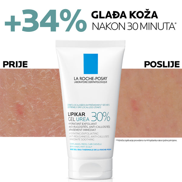 La Roche-Posay LIPIKAR gel s 30% ureje za ciljanu primjenu na suha i gruba područja kože, 50 ml 
