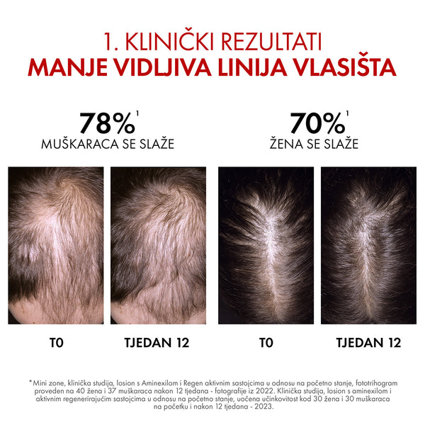 VICHY DERCOS AMINEXIL CLINICAL REGEN BOOSTER - Serum za obnovu kose 90 ml