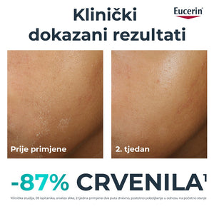 Eucerin DermoPure Clinical dopunska umirujuća krema 40 ml