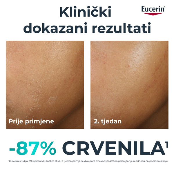 Eucerin DermoPure Clinical dopunska umirujuća krema 40 ml