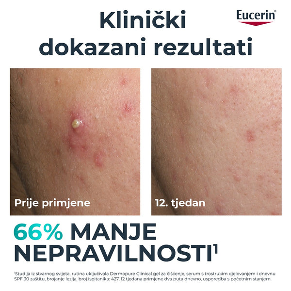 Eucerin DermoPure Clinical serum sa trostrukim djelovanjem 40 ml