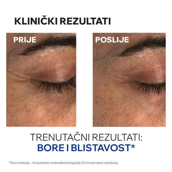 Uriage AGE ABSOLU balzam za područje oko očiju 15 ml