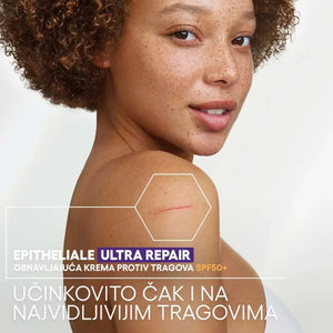 A-Derma Epitheliale ULTRA REPAIR SPF50+ obnavljajuća krema protiv tragova 40 ml