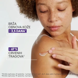 A-Derma Epitheliale ULTRA REPAIR SPF50+ obnavljajuća krema protiv tragova 40 ml