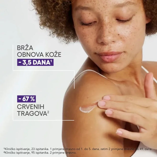A-Derma Epitheliale ULTRA REPAIR SPF50+ obnavljajuća krema protiv tragova 40 ml