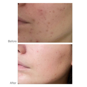Advanced Nutrition SKIN CLEAR BIOME 60 kapsula