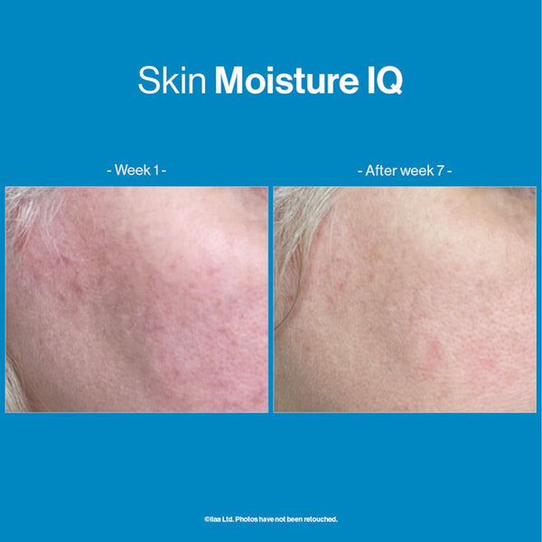 Advanced Nutrition SKIN MOISTURE IQ 140 kapsula