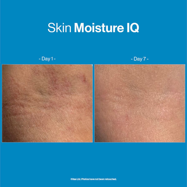 Advanced Nutrition SKIN MOISTURE IQ 140 kapsula