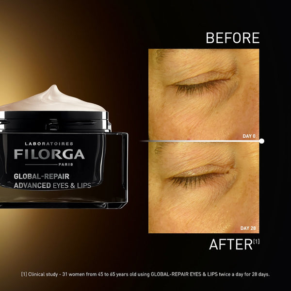 Filorga GLOBAL-REPAIR ADVANCED EYES&LIPS krema za područje oko očiju i usana 15 ml