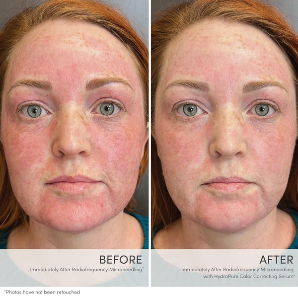 Jane Iredale HydroPure Colour Correcting Serum