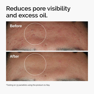 The Ordinary Niacinamide 10% + Zinc 1% 30 ml