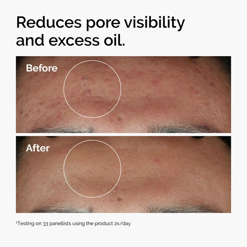 The Ordinary Niacinamide 10% + Zinc 1% 30 ml