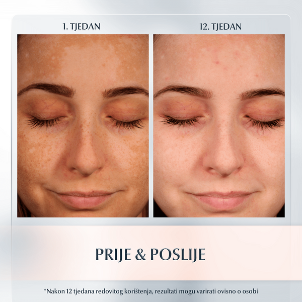 Eucerin Anti-Pigment dnevna krema za sve tipove kože SPF30 50 ml