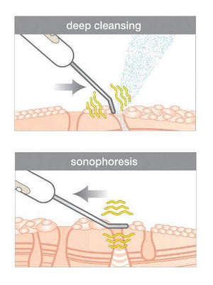 Rio Ultrasonic Facial