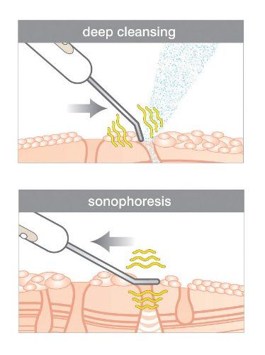 Rio Ultrasonic Facial